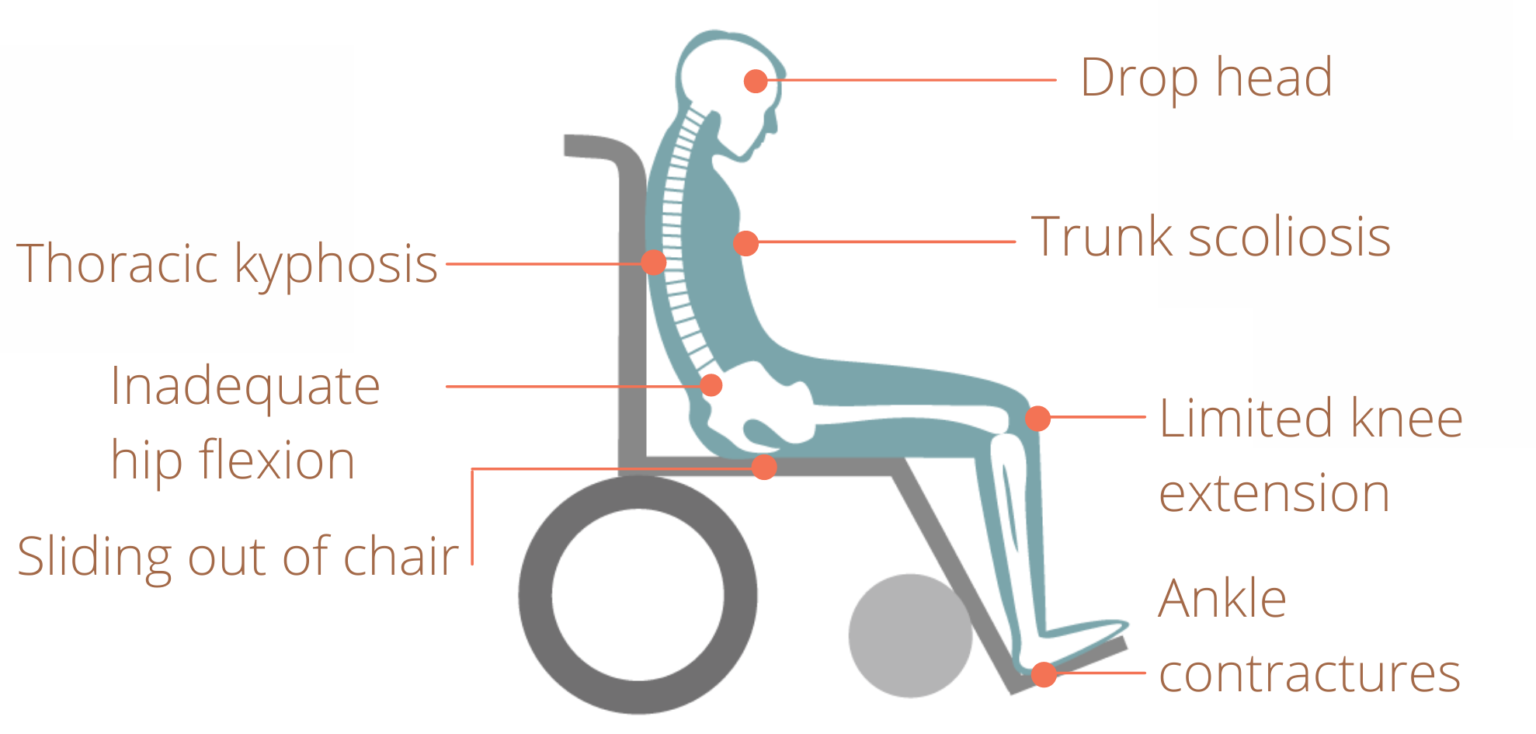 Best Tips to Prevent Elderly Sliding Forward From in a Wheelchair